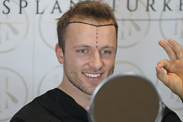 WhatisFUEtechniq-copy.jpg
