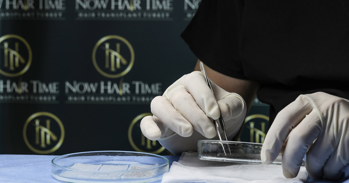 hairtransplantwithstemcell.jpg