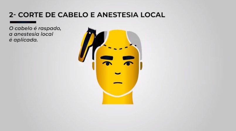 newtodoocabelo.jpg