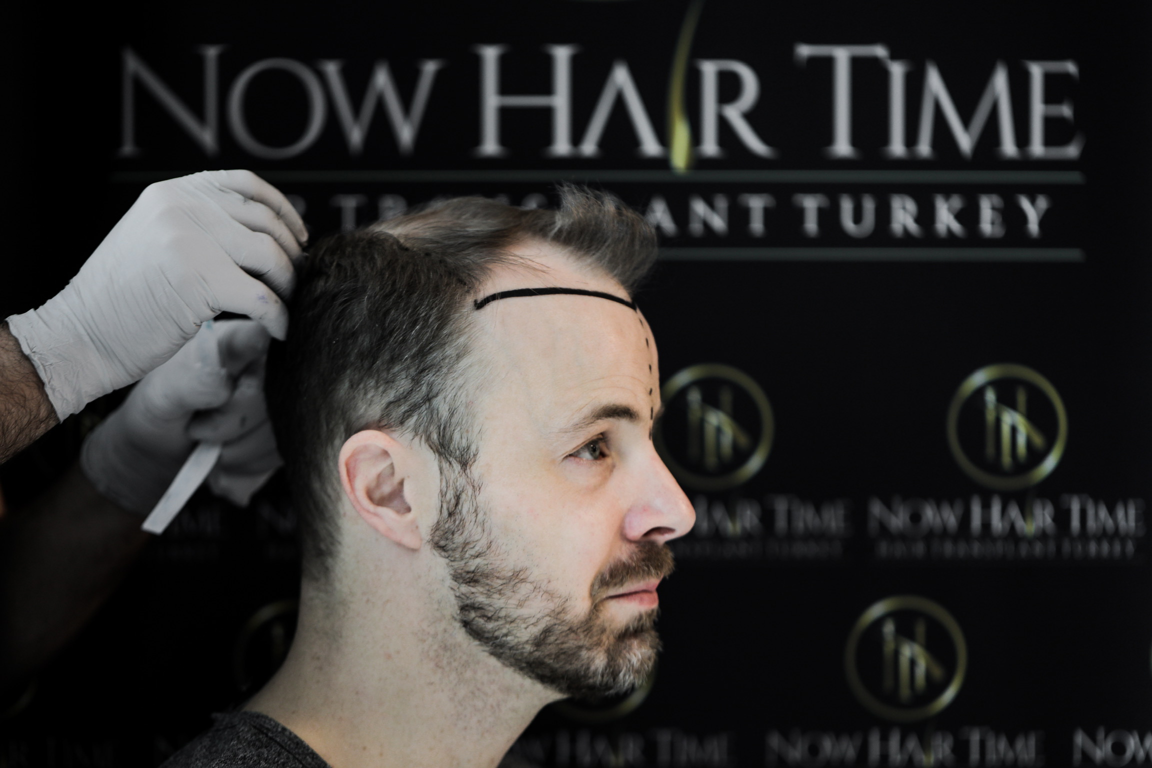 nowhairtimeexistem.jpeg
