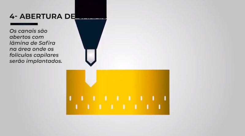 nowtransplanteeraspado.jpg