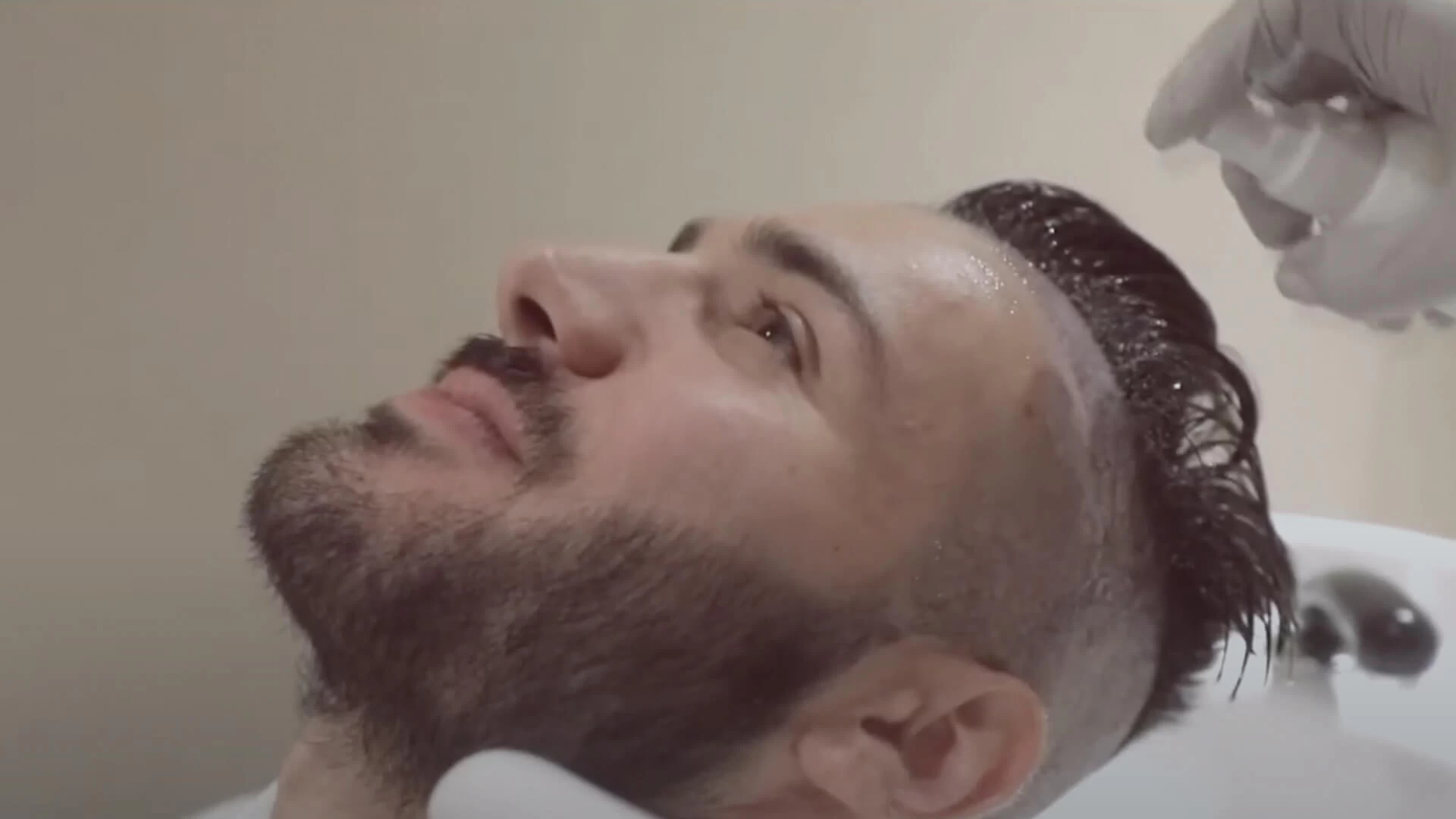 Lavagem Depois do Transplante Capilar