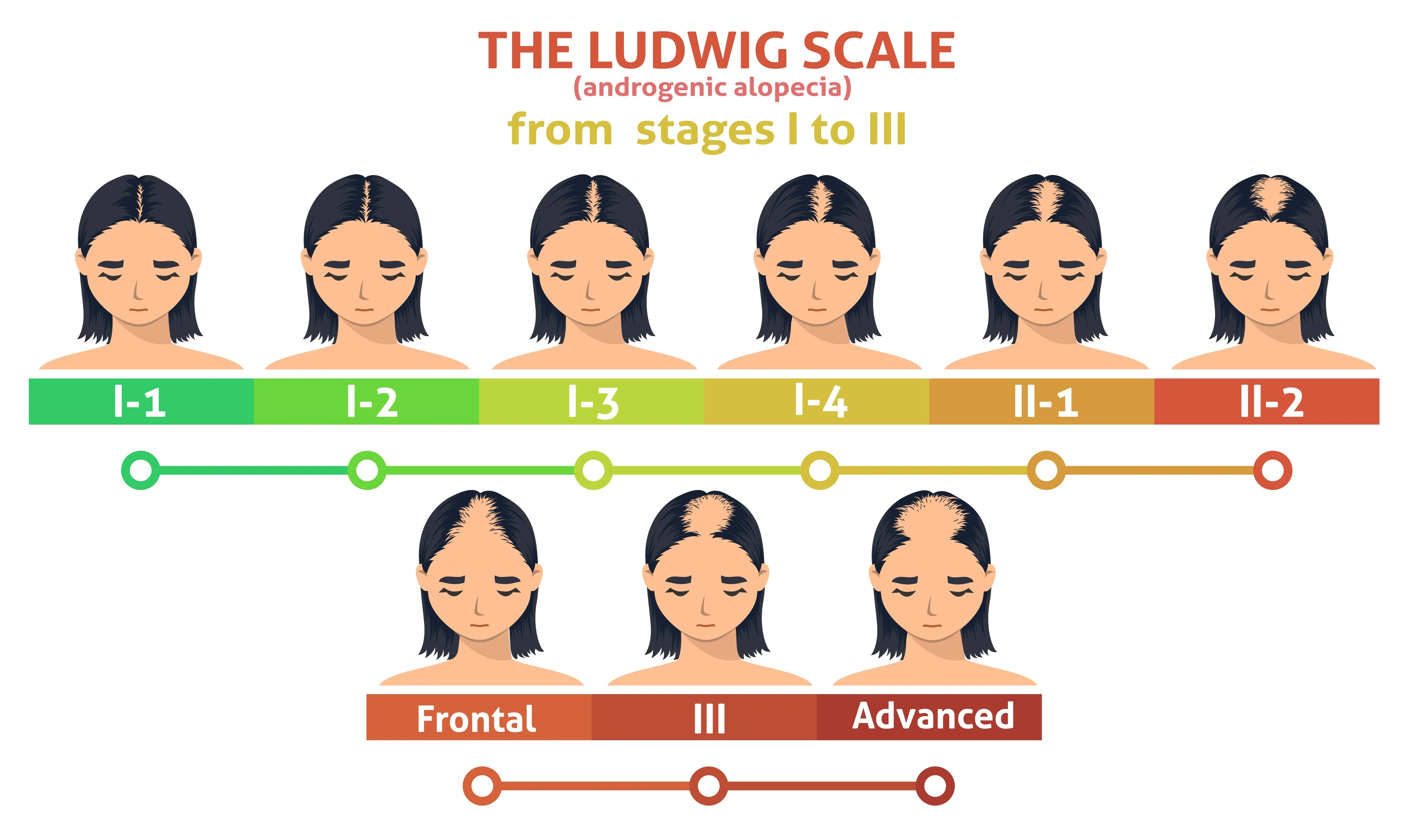 ludwig-scale-across-stages.jpeg
