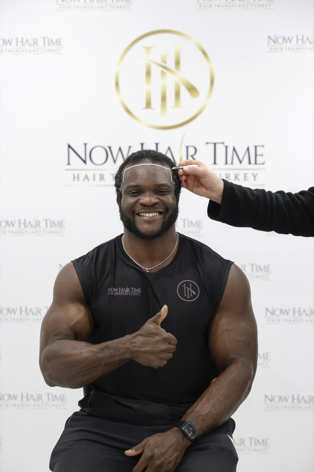 Hair transplant patient at Now Hair Time, Istanbul