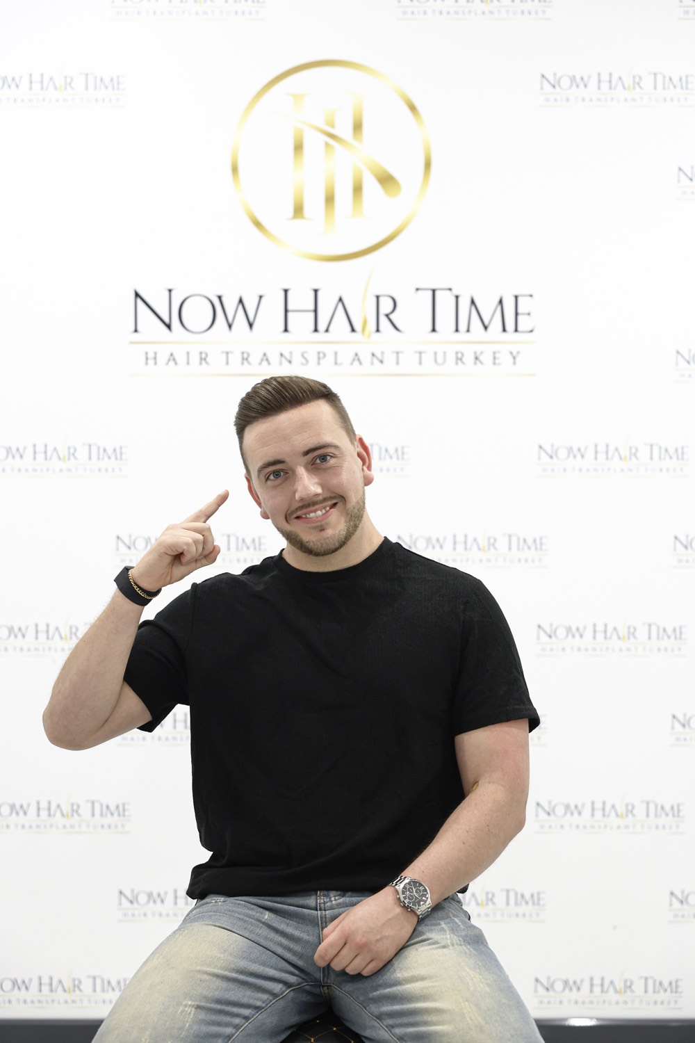 Hair Transplant Alternatives: Non-Surgical Options for Hair Loss