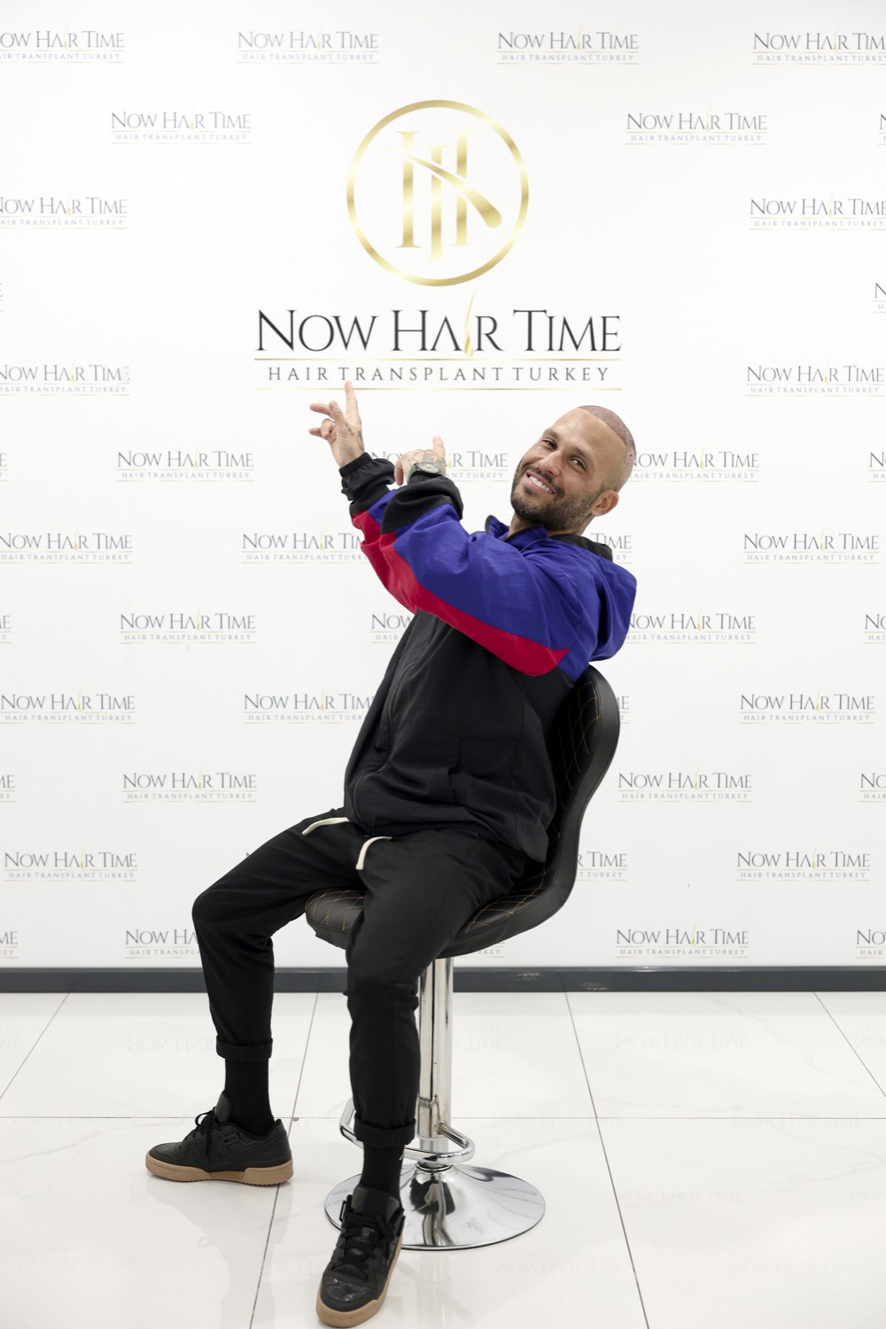 Paciente de transplante capilar na Now Hair Time, Istambul