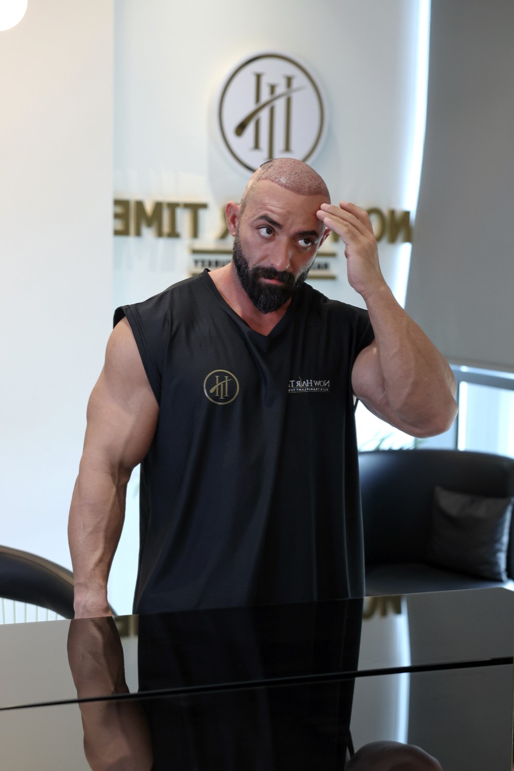 Hair transplant patient at Now Hair Time, Istanbul