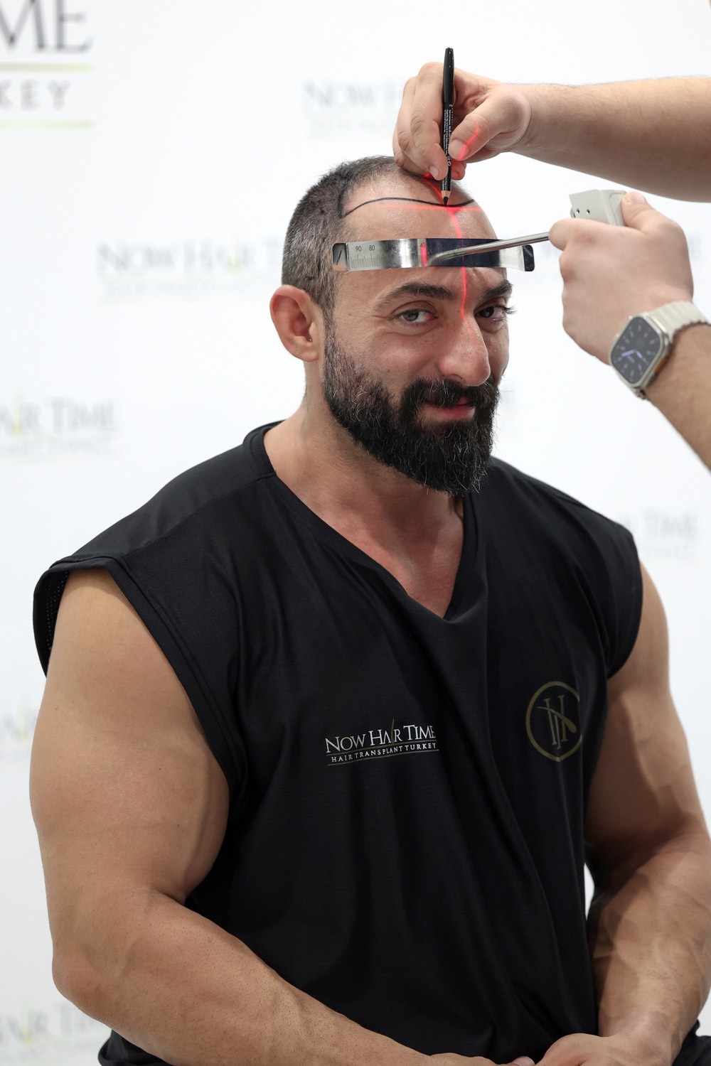 How to Choose the Best Hair Transplant Clinic: A Complete Checklist