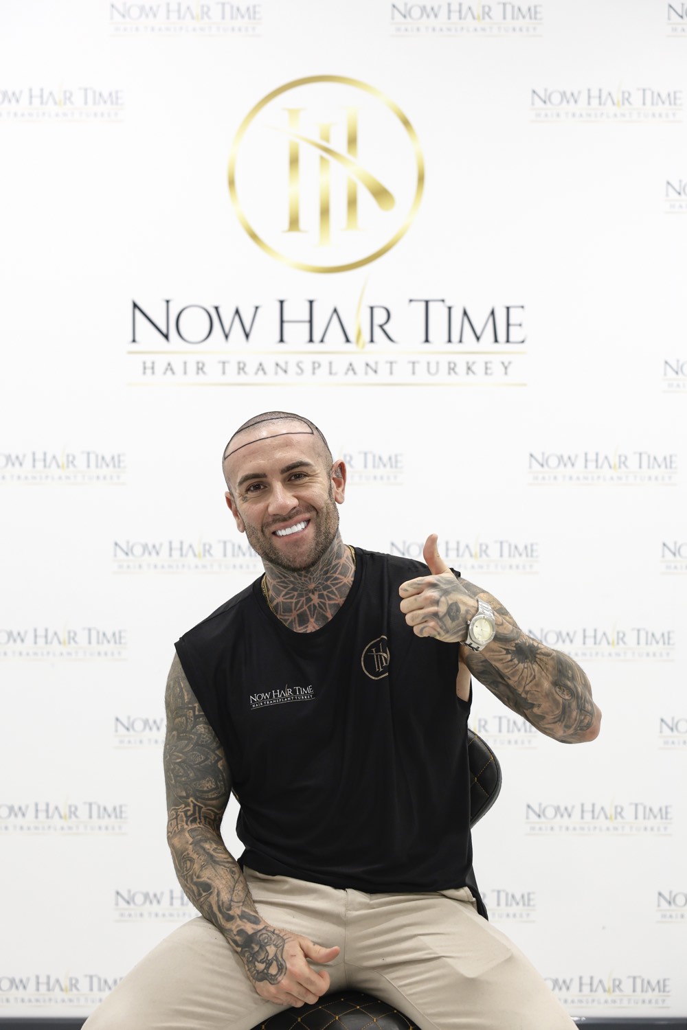 Hair transplant patient at Now Hair Time, Istanbul