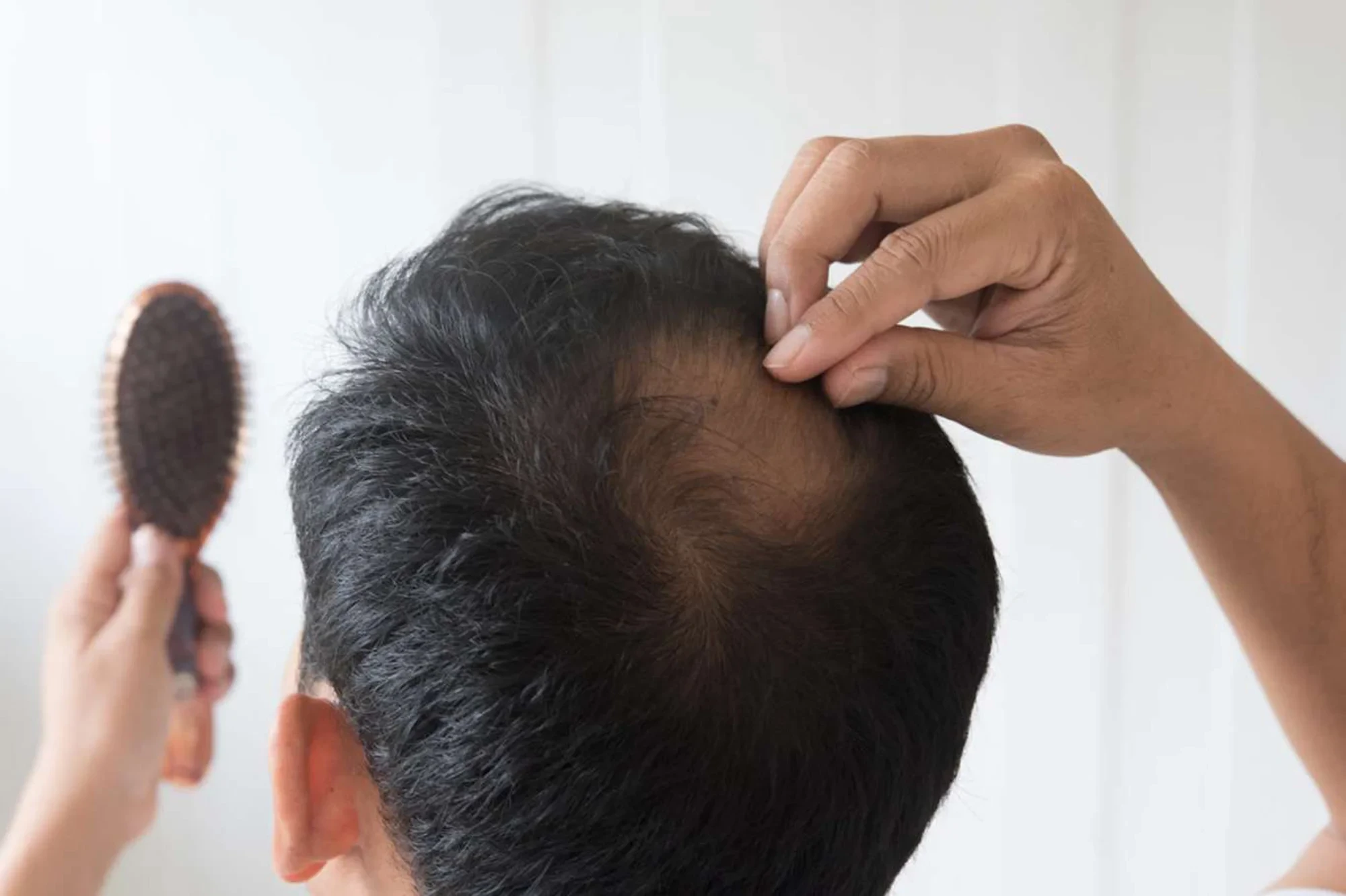 7 Reasons Why You're Suddenly Losing Your Hair