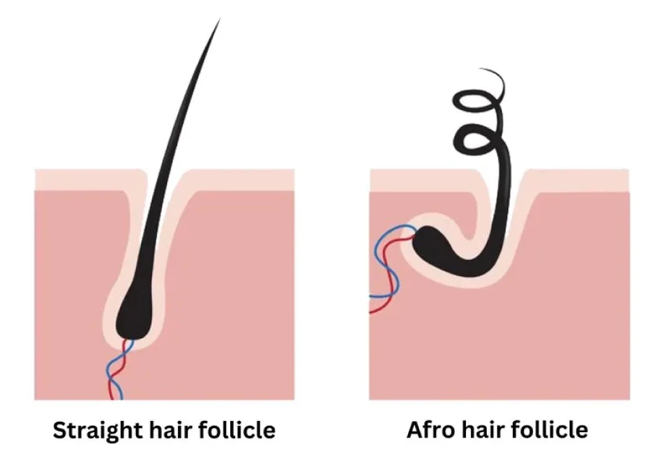 Why Afro Hair Follicles Curve Beneath the Skin